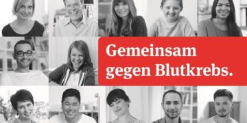 DKMS