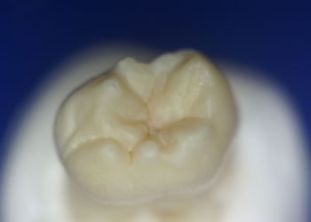 Wikipedia, CC Lizenz