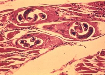 Wikipedia gemeinfrei