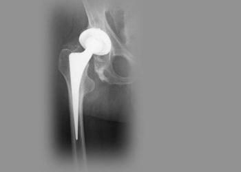 Wiki CC 3.0 Scuba-limp~commonswiki