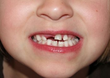 Wiki CC3.0 David_Shankbone