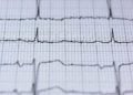 Krankenhäuser in der Region behandeln mehr Herz-Kreislauf-Patienten