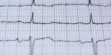 Krankenhäuser in der Region behandeln mehr Herz-Kreislauf-Patienten