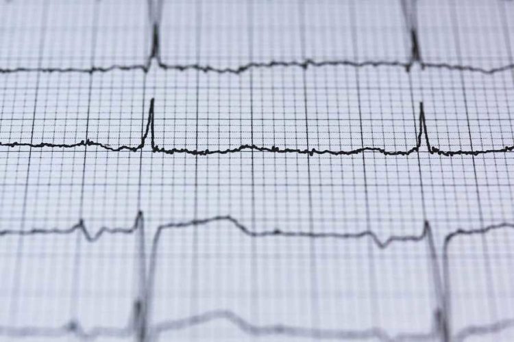 Krankenhäuser in der Region behandeln mehr Herz-Kreislauf-Patienten