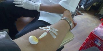 mostlimb