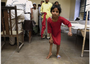 Ein Mädchen mit schwerer Gehbehinderung bei einem von Rotary und dem indischen Gesundheitsministerium organisierten Polio Camp, in dem Post-Polio-Patienten untersucht werden; Rotary International