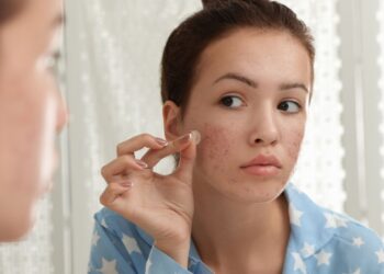 Blasenpflaster gegen Pickel: Wie sind die Erfahrungen?