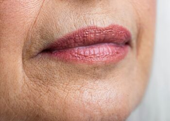 Raucherfalten am Mund: Mit diesen Tipps kann man sie loswerden!