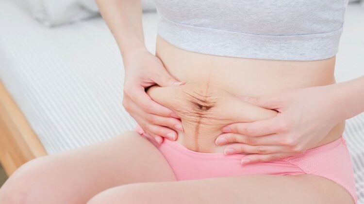 Frau sitzt auf einem Bett und hält die Bauchhaut nach der Geburt